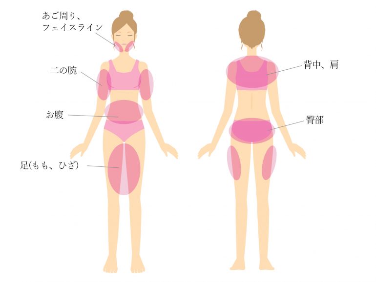 脂肪溶解注射場所