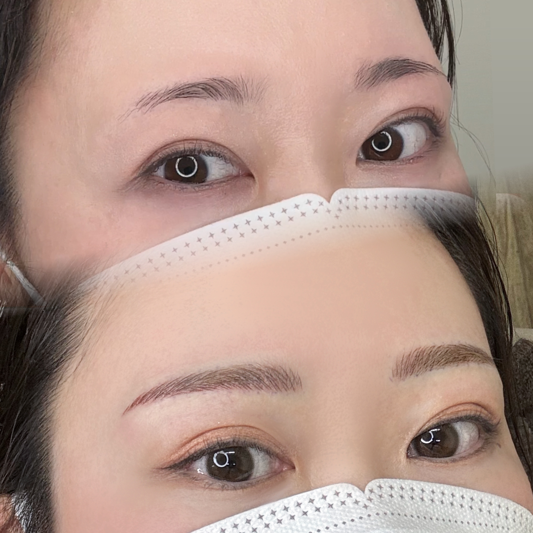 医療アートメイク｜長野市でハイクオリティなアートメイクを受けるなら